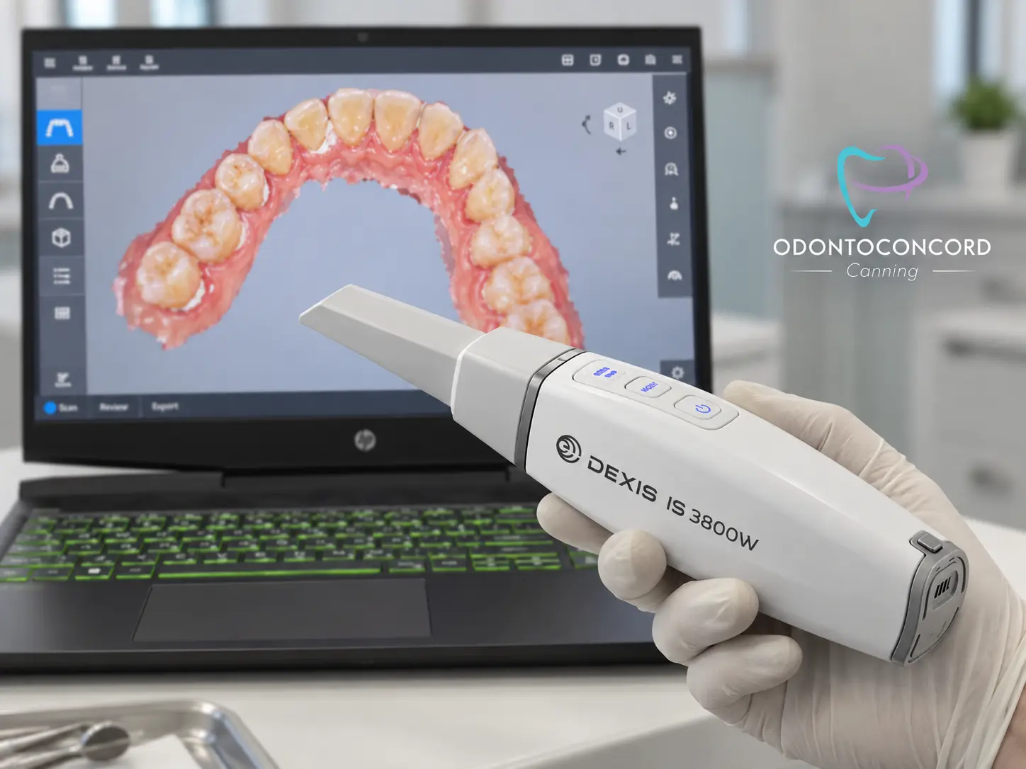 Scanner intraoral digital disponible en Odonto Concord Canning
